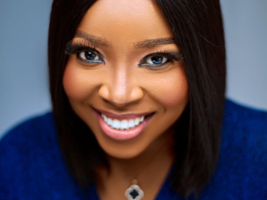 Ortodonzia Adulto - Correzione Morso Aperto - Dopo