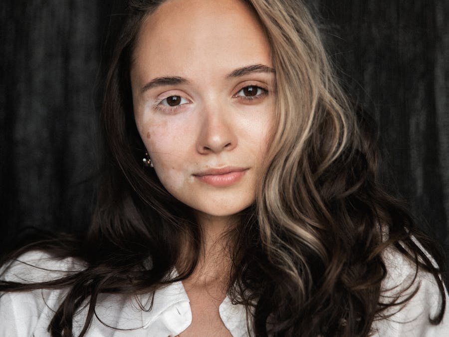 Terapia ATM con Bite Plane - Dopo