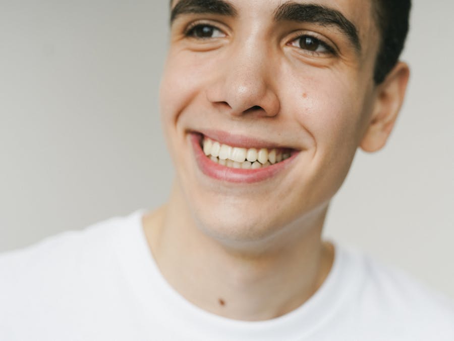 Impianti con Rigenerazione Ossea Guidata - Dopo