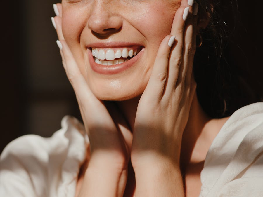 Riabilitazione Full Arch All-on-4 - Dopo